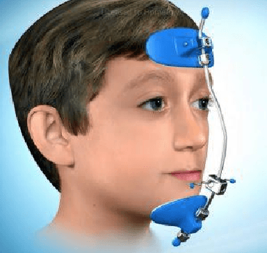 Myofunctional Treatment - Main View