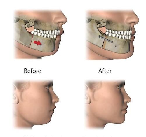 Orthognathic Surgery - Main View